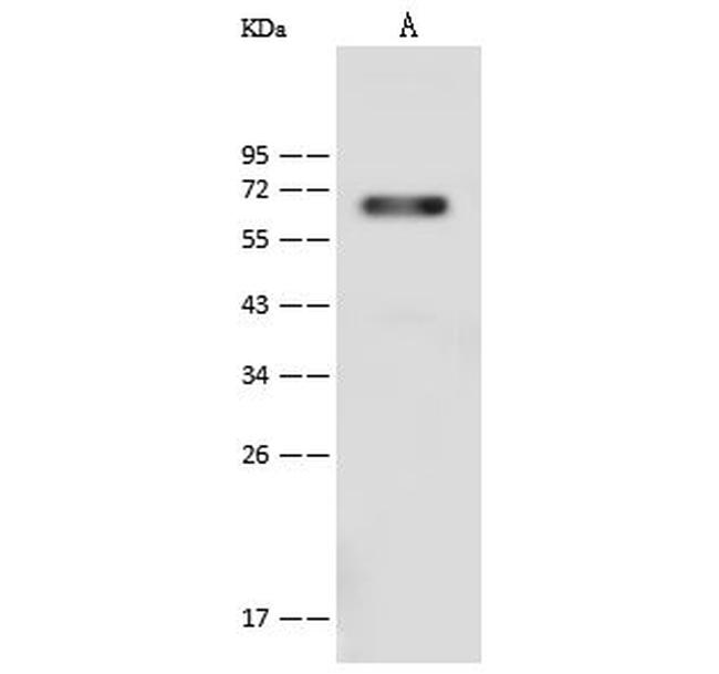 CD96 Antibody in Western Blot (WB)