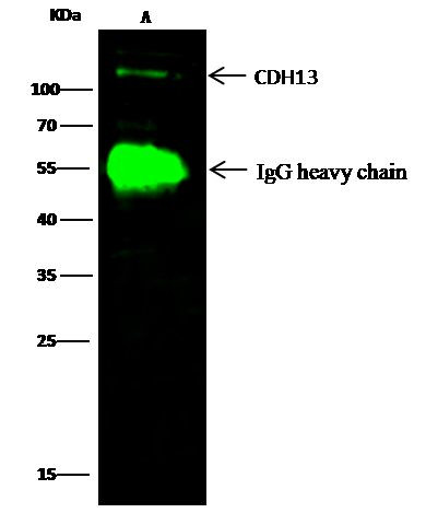 H-cadherin Antibody in Immunoprecipitation (IP)