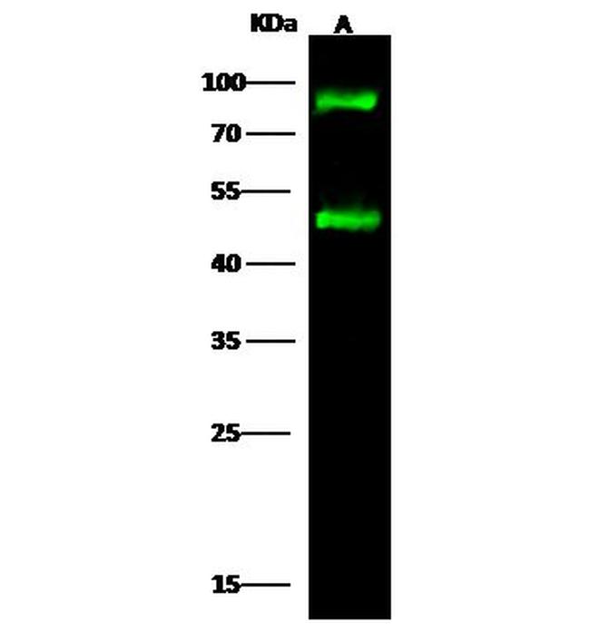 H-cadherin Antibody in Western Blot (WB)