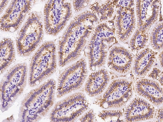 CDH17 Antibody in Immunohistochemistry (Paraffin) (IHC (P))