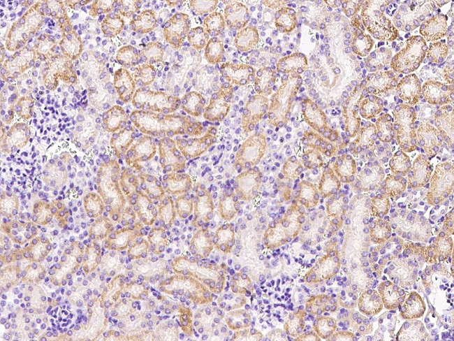 P-cadherin Antibody in Immunohistochemistry (Paraffin) (IHC (P))