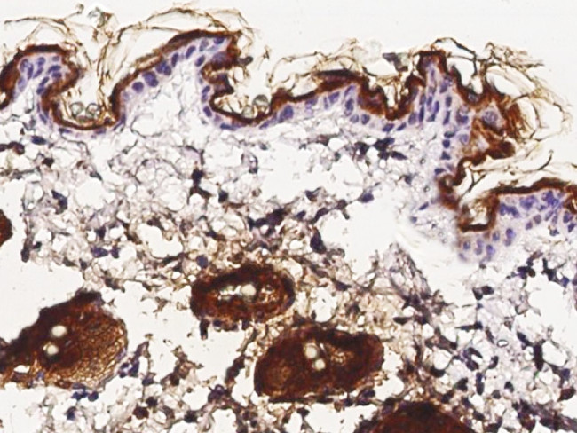 Cystatin M Antibody in Immunohistochemistry (Paraffin) (IHC (P))