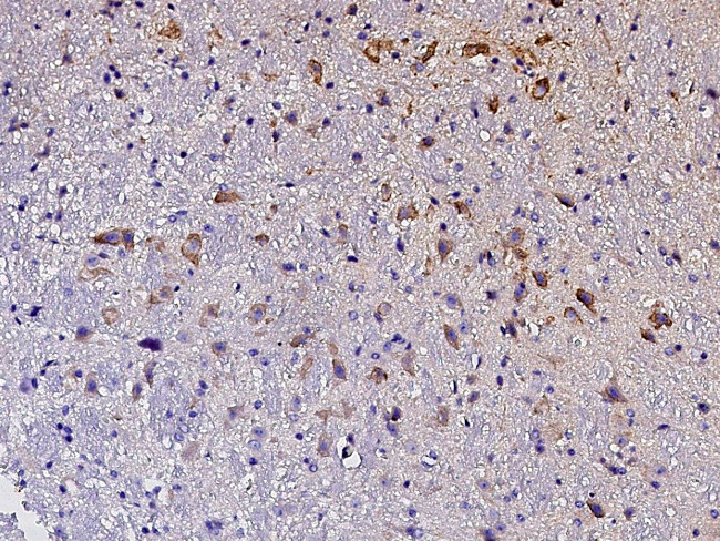 Ephrin A3 Antibody in Immunohistochemistry (Paraffin) (IHC (P))