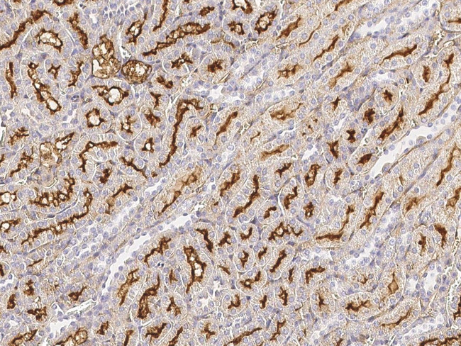 CD249 Antibody in Immunohistochemistry (Paraffin) (IHC (P))