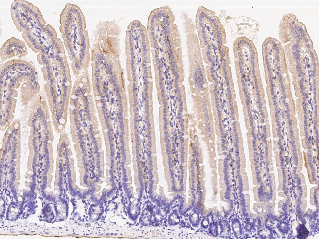 CD178 Antibody in Immunohistochemistry (Paraffin) (IHC (P))