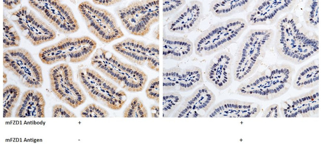 FZD1 Antibody in Immunohistochemistry (Paraffin) (IHC (P))