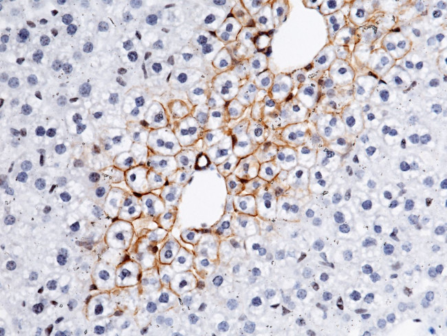 E-cadherin Antibody in Immunohistochemistry (Paraffin) (IHC (P))