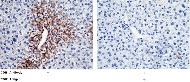 E-cadherin Antibody in Immunohistochemistry (Paraffin) (IHC (P))