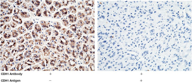 E-cadherin Antibody in Immunohistochemistry (Paraffin) (IHC (P))