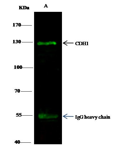 E-cadherin Antibody in Immunoprecipitation (IP)