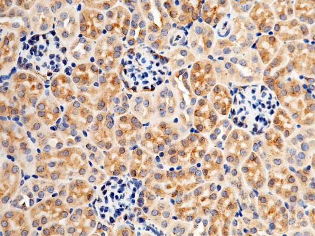 Growth Hormone Receptor Antibody in Immunohistochemistry (Paraffin) (IHC (P))