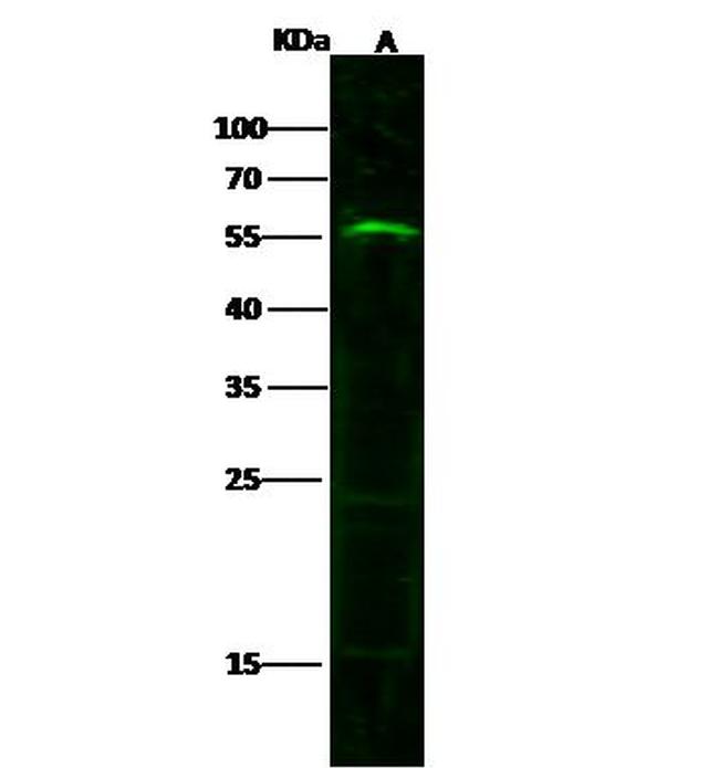 Growth Hormone Receptor Antibody in Western Blot (WB)
