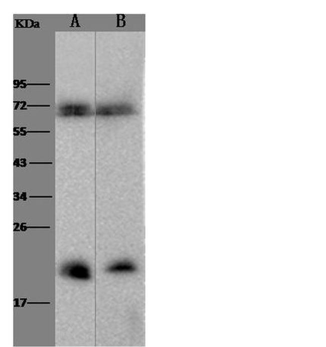 IL-18 Antibody in Western Blot (WB)