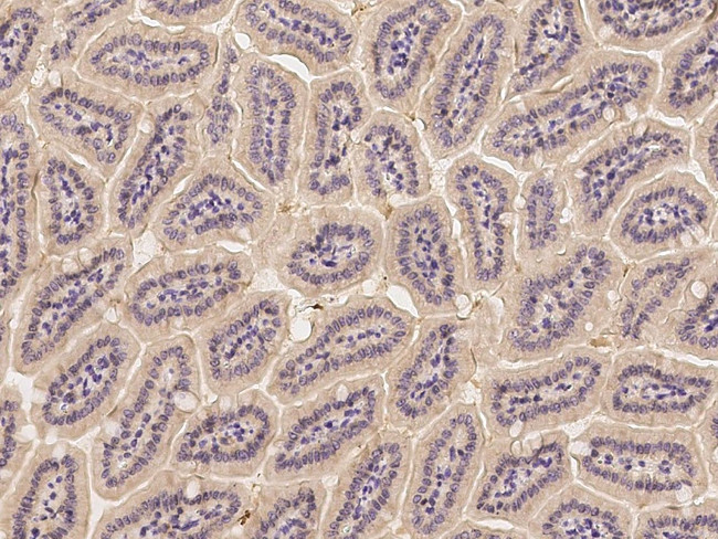 IL1R1 Antibody in Immunohistochemistry (Paraffin) (IHC (P))