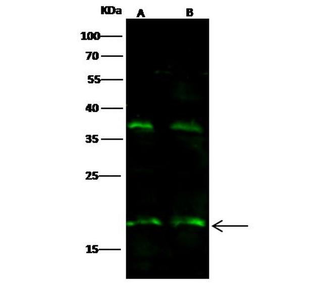 IL-5 Antibody in Western Blot (WB)