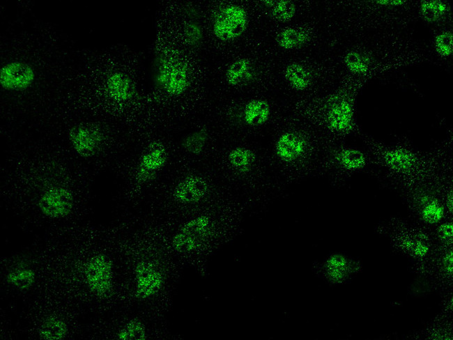 IRF6 Antibody in Immunocytochemistry (ICC/IF)