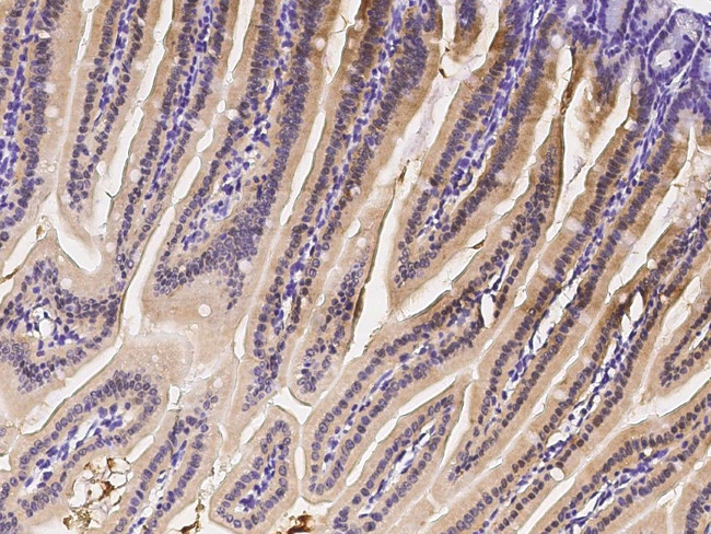 IRF6 Antibody in Immunohistochemistry (Paraffin) (IHC (P))