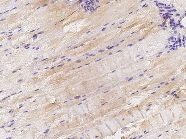 ITGA3 Antibody in Immunohistochemistry (Paraffin) (IHC (P))