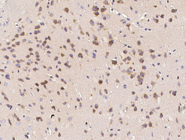 LDLR Antibody in Immunohistochemistry (Paraffin) (IHC (P))