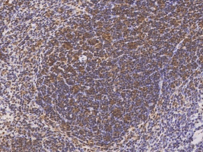 LILRB4 Antibody in Immunohistochemistry (Paraffin) (IHC (P))