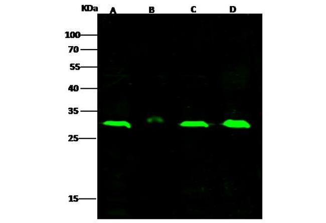 IkB beta Antibody in Western Blot (WB)