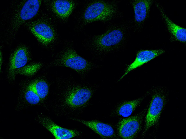 PCSK9 Antibody in Immunocytochemistry (ICC/IF)