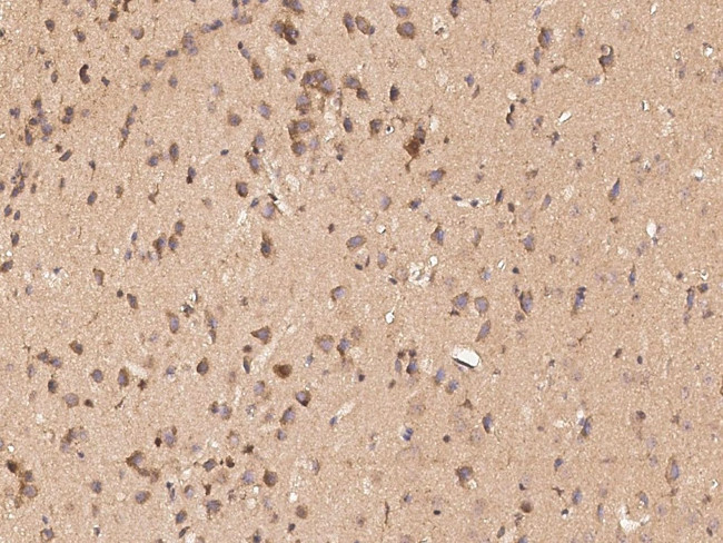 PCSK9 Antibody in Immunohistochemistry (Paraffin) (IHC (P))