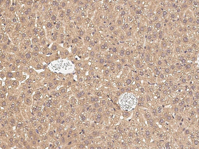 PCSK9 Antibody in Immunohistochemistry (Paraffin) (IHC (P))