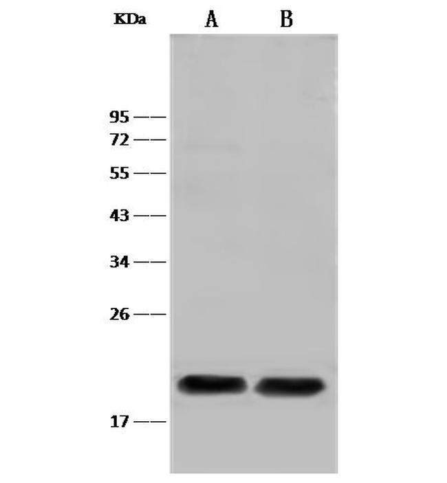 PLA2 Antibody in Western Blot (WB)