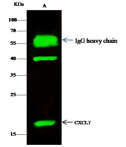 PPBP Antibody in Immunoprecipitation (IP)