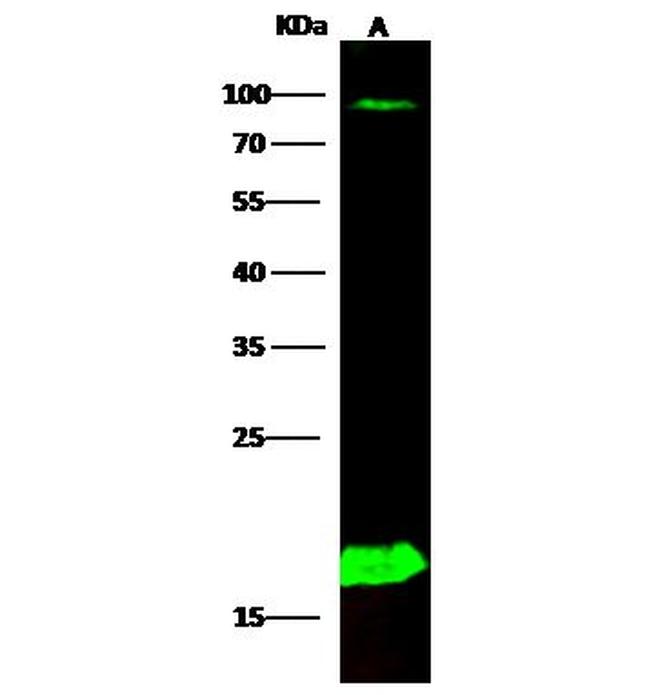 PPBP Antibody in Western Blot (WB)