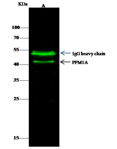 PPM1A Antibody in Immunoprecipitation (IP)