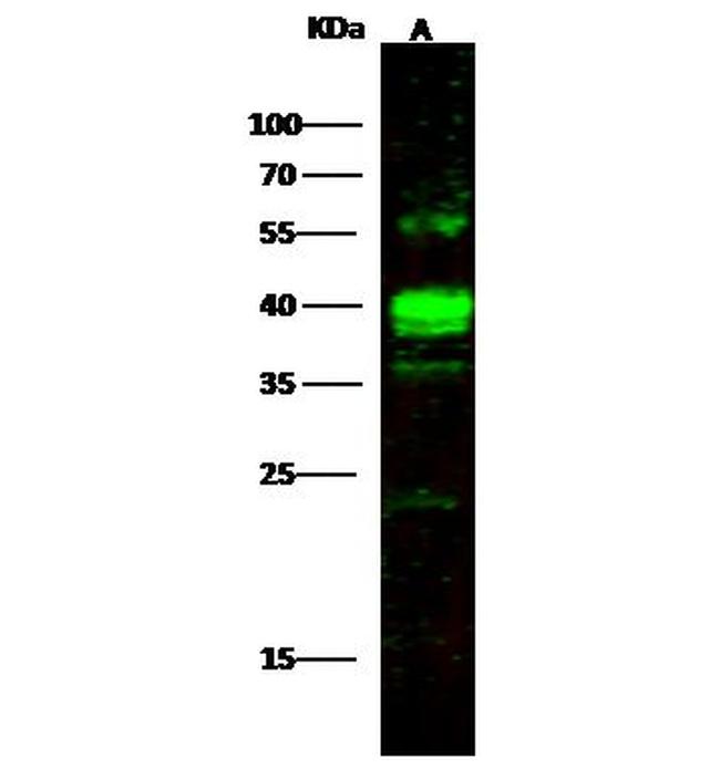 PPM1A Antibody in Western Blot (WB)