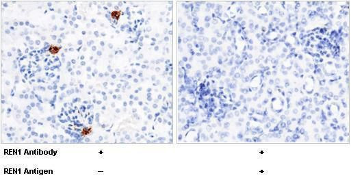 Renin Antibody in Immunohistochemistry (Paraffin) (IHC (P))