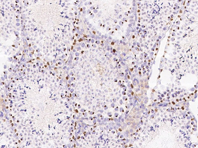 SALL4 Antibody in Immunohistochemistry (Paraffin) (IHC (P))