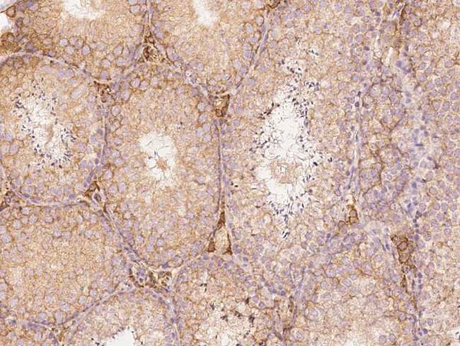 SLC27A3 Antibody in Immunohistochemistry (Paraffin) (IHC (P))