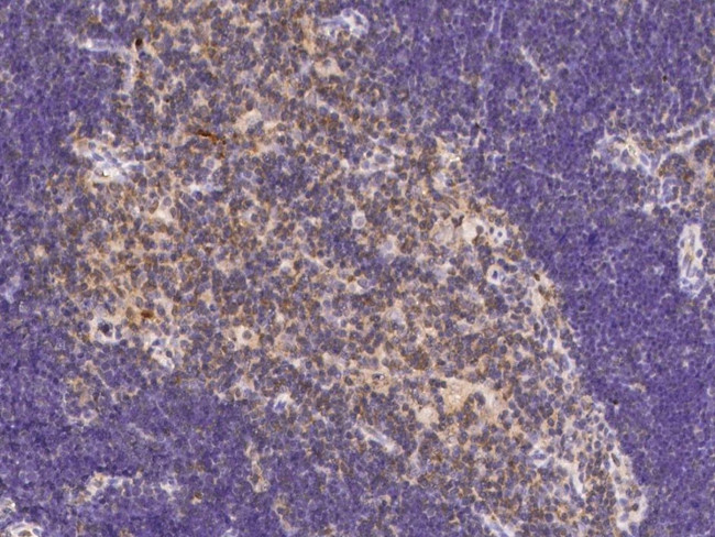 CD267 (TACI) Antibody in Immunohistochemistry (Paraffin) (IHC (P))