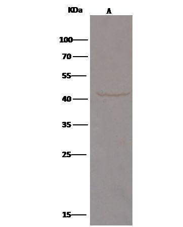 TNFR2 Antibody in Immunoprecipitation (IP)