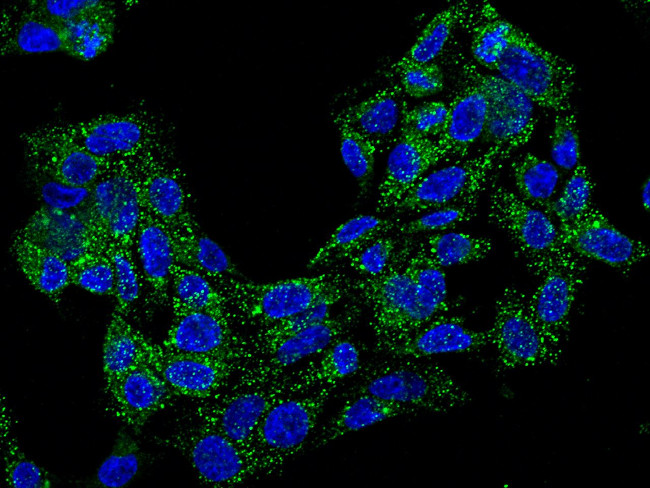 TREM1 Antibody in Immunocytochemistry (ICC/IF)