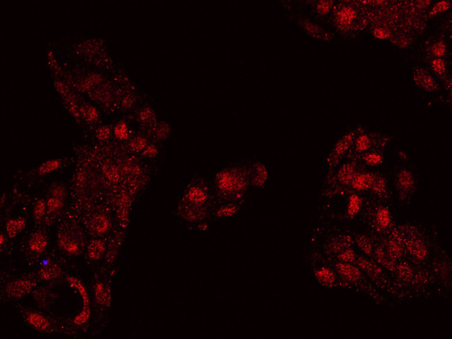 FOXP2 Antibody in Immunocytochemistry (ICC/IF)