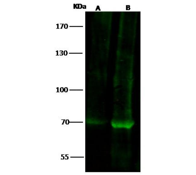 FOXP2 Antibody in Western Blot (WB)