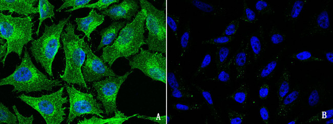 FXR1 Antibody in Immunocytochemistry (ICC/IF)