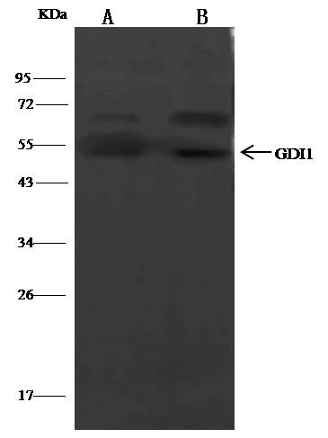 GDI1 Antibody in Immunoprecipitation (IP)