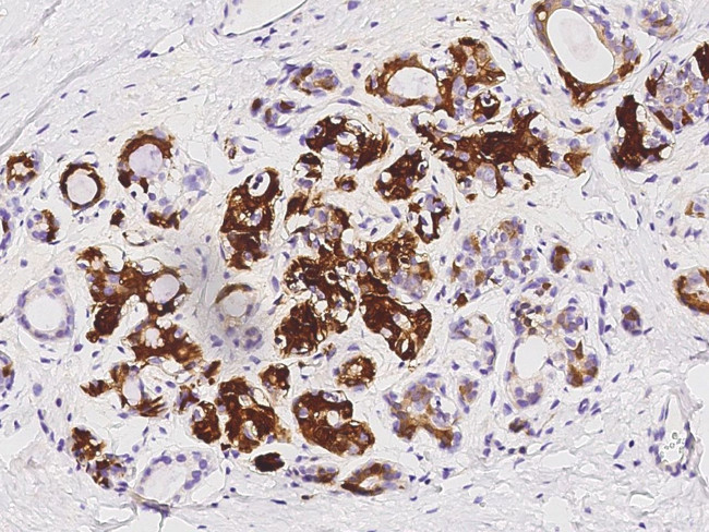 Glutamine Synthetase Antibody in Immunohistochemistry (Paraffin) (IHC (P))