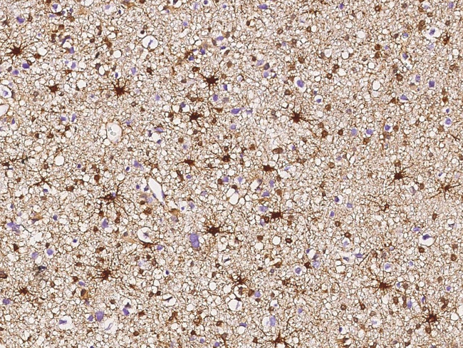 Glutamine Synthetase Antibody in Immunohistochemistry (Paraffin) (IHC (P))