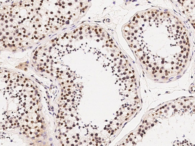 HDAC1 Antibody in Immunohistochemistry (Paraffin) (IHC (P))