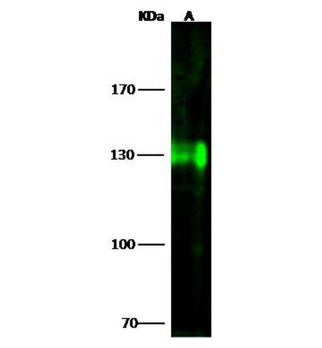 CD51 Antibody in Western Blot (WB)