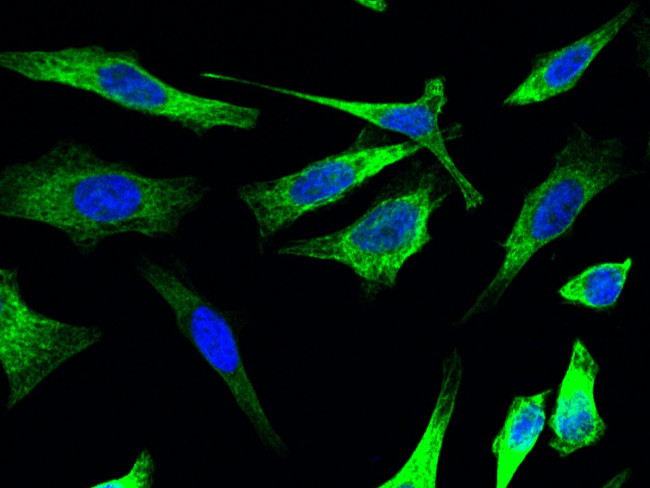 Cytokeratin 17 Antibody in Immunocytochemistry (ICC/IF)