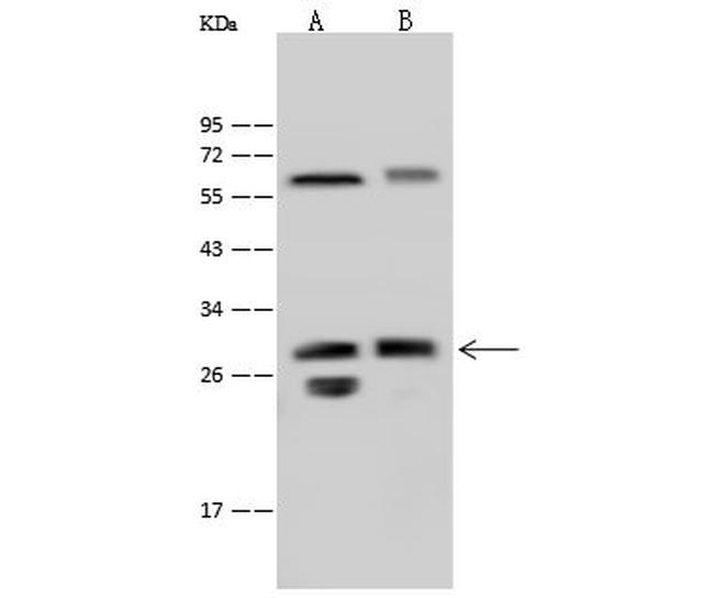 LIN7A Antibody in Western Blot (WB)