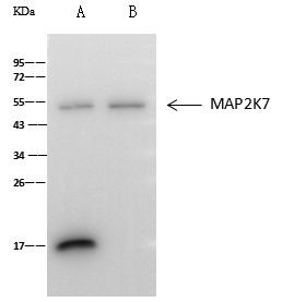 MEK7 Antibody in Immunoprecipitation (IP)